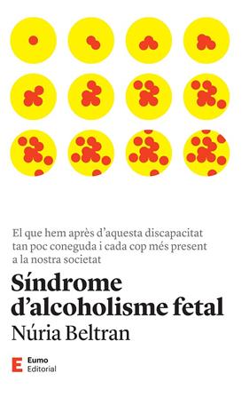SÍNDROME D'ALCOHOLISME FETAL | 9788497668149 | BELTRAN CENTELLES, NÚRIA